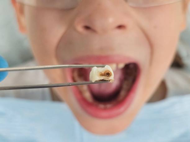 Best Dentist for Tooth Abscess  in Ridgway, PA