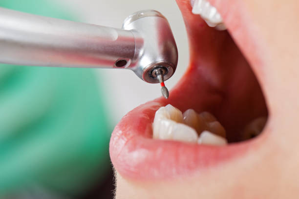 Best Urgent Tooth Repair  in Ridgway, PA